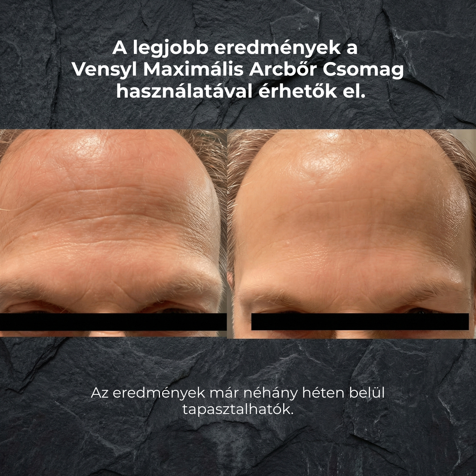 Terra feszesítő arcszérum